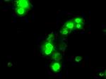 SATB1 Antibody in Immunocytochemistry (ICC/IF)