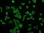 SATB1 Antibody in Immunocytochemistry (ICC/IF)