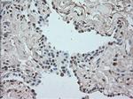 SATB1 Antibody in Immunohistochemistry (Paraffin) (IHC (P))