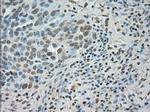 SATB1 Antibody in Immunohistochemistry (Paraffin) (IHC (P))