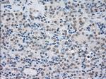 SATB1 Antibody in Immunohistochemistry (Paraffin) (IHC (P))