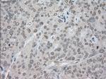 SATB1 Antibody in Immunohistochemistry (Paraffin) (IHC (P))