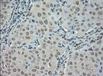 SATB1 Antibody in Immunohistochemistry (Paraffin) (IHC (P))