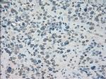 SATB1 Antibody in Immunohistochemistry (Paraffin) (IHC (P))