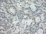 SATB1 Antibody in Immunohistochemistry (Paraffin) (IHC (P))