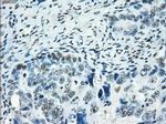 SATB1 Antibody in Immunohistochemistry (Paraffin) (IHC (P))