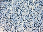 SATB1 Antibody in Immunohistochemistry (Paraffin) (IHC (P))