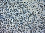 SATB1 Antibody in Immunohistochemistry (Paraffin) (IHC (P))