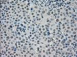 SATB1 Antibody in Immunohistochemistry (Paraffin) (IHC (P))