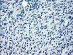 SATB1 Antibody in Immunohistochemistry (Paraffin) (IHC (P))