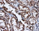 SATB1 Antibody in Immunohistochemistry (Paraffin) (IHC (P))