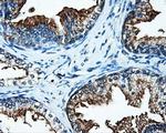 SATB1 Antibody in Immunohistochemistry (Paraffin) (IHC (P))