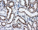 SATB1 Antibody in Immunohistochemistry (Paraffin) (IHC (P))