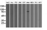 SATB1 Antibody in Western Blot (WB)