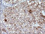 SCARB1 Antibody in Immunohistochemistry (Paraffin) (IHC (P))