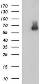 SCARB1 Antibody in Western Blot (WB)