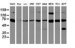 SCFD1 Antibody in Western Blot (WB)