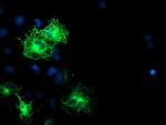 SCHIP1 Antibody in Immunocytochemistry (ICC/IF)