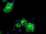 SCHIP1 Antibody in Immunocytochemistry (ICC/IF)