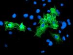SCHIP1 Antibody in Immunocytochemistry (ICC/IF)