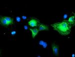 SCHIP1 Antibody in Immunocytochemistry (ICC/IF)