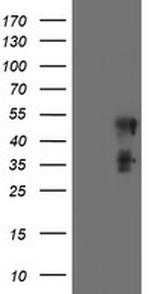 SCHIP1 Antibody in Western Blot (WB)