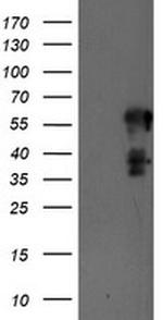 SCHIP1 Antibody in Western Blot (WB)