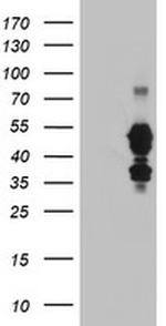 SCHIP1 Antibody in Western Blot (WB)