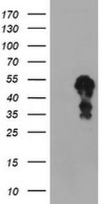 SCHIP1 Antibody in Western Blot (WB)