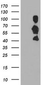 SCHIP1 Antibody in Western Blot (WB)