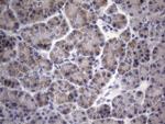 SCMH1 Antibody in Immunohistochemistry (Paraffin) (IHC (P))