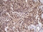 SCMH1 Antibody in Immunohistochemistry (Paraffin) (IHC (P))