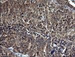 SCP2 Antibody in Immunohistochemistry (Paraffin) (IHC (P))