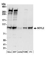 SCYL2 Antibody in Western Blot (WB)