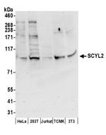 SCYL2 Antibody in Western Blot (WB)