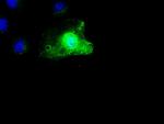 SCYL3 Antibody in Immunocytochemistry (ICC/IF)