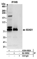 SDAD1 Antibody in Immunoprecipitation (IP)