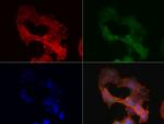 SDCBP Antibody in Immunocytochemistry (ICC/IF)