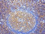 SDCBP Antibody in Immunohistochemistry (Paraffin) (IHC (P))