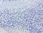 SDCBP Antibody in Immunohistochemistry (Paraffin) (IHC (P))