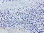 SDCBP Antibody in Immunohistochemistry (Paraffin) (IHC (P))