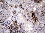 SDCBP Antibody in Immunohistochemistry (Paraffin) (IHC (P))