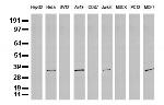 SDCBP Antibody in Western Blot (WB)