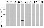 SDCBP Antibody in Western Blot (WB)