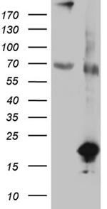 SDHAF1 Antibody in Western Blot (WB)