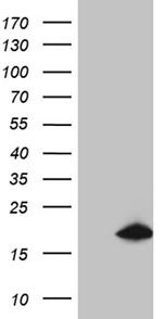 SDHAF1 Antibody in Western Blot (WB)