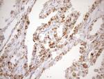 SDHB Antibody in Immunohistochemistry (Paraffin) (IHC (P))