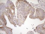 SDHB Antibody in Immunohistochemistry (Paraffin) (IHC (P))