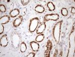 SDHB Antibody in Immunohistochemistry (Paraffin) (IHC (P))