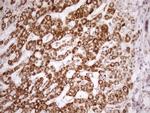 SDHB Antibody in Immunohistochemistry (Paraffin) (IHC (P))